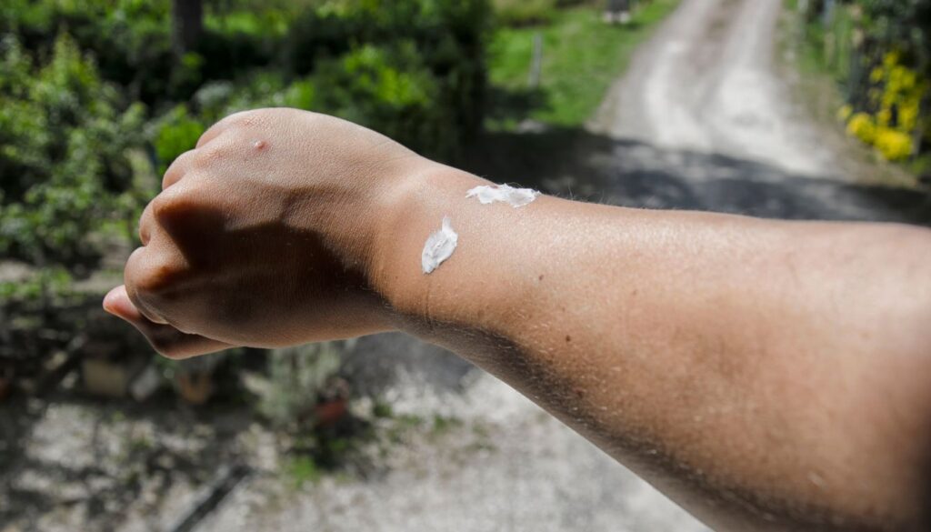 Premiers Soins après Piqûre Abeille
